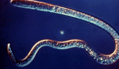Tipos de parasitos no corpo humano