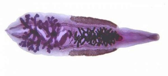 Coincidencia siberiana