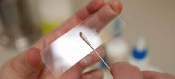 Raiar para ovos de verme